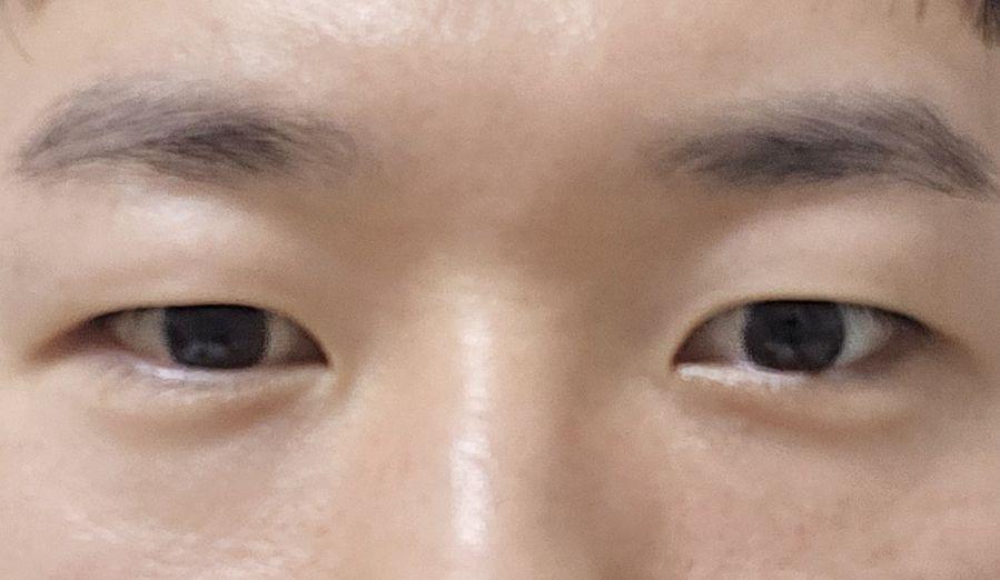 後