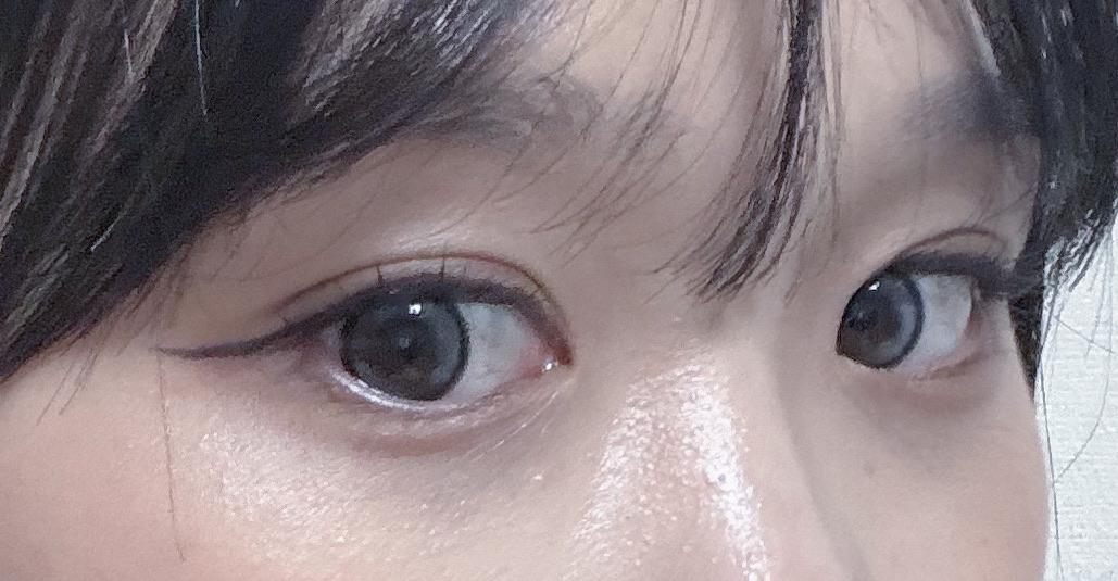 後