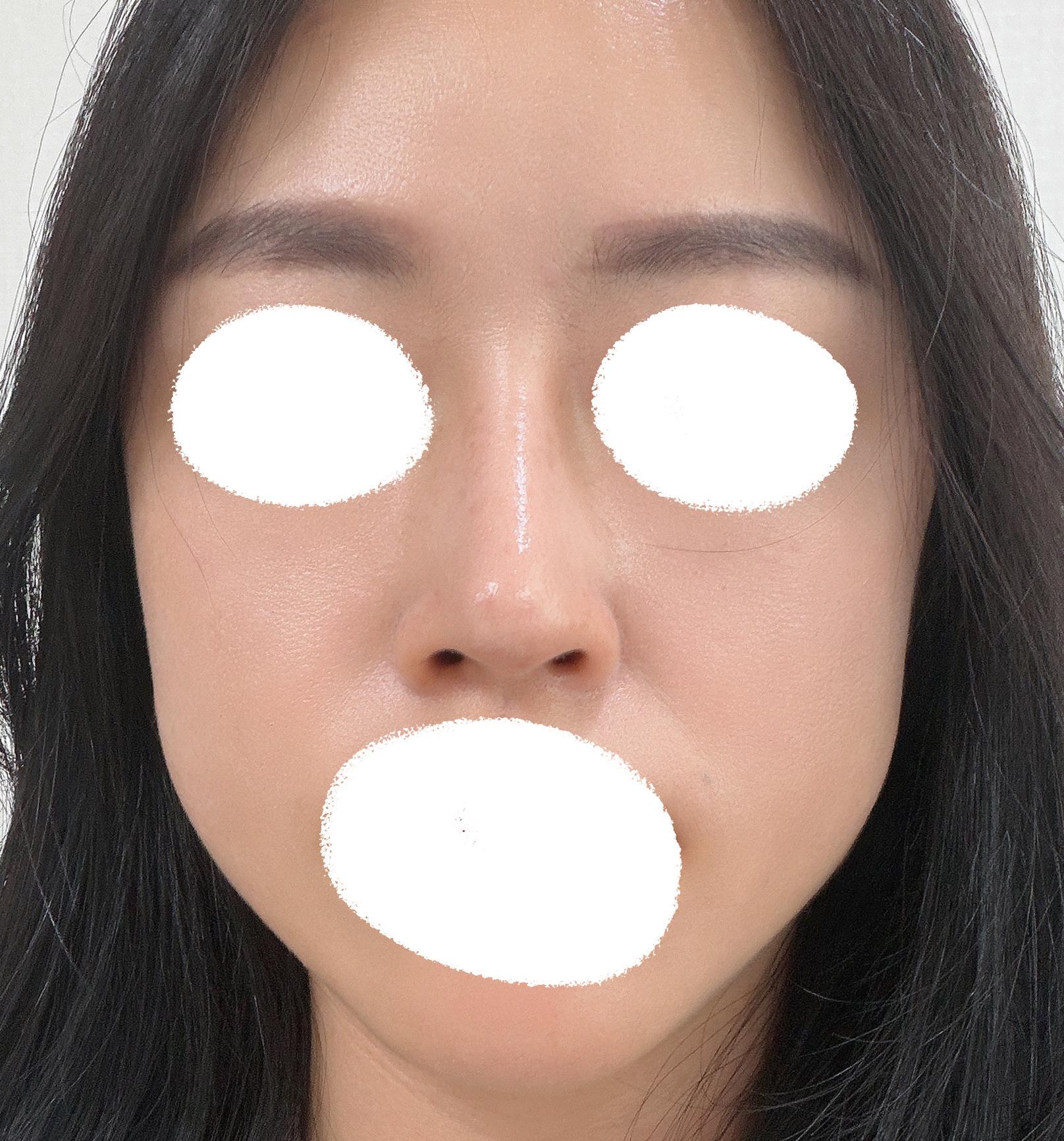 後