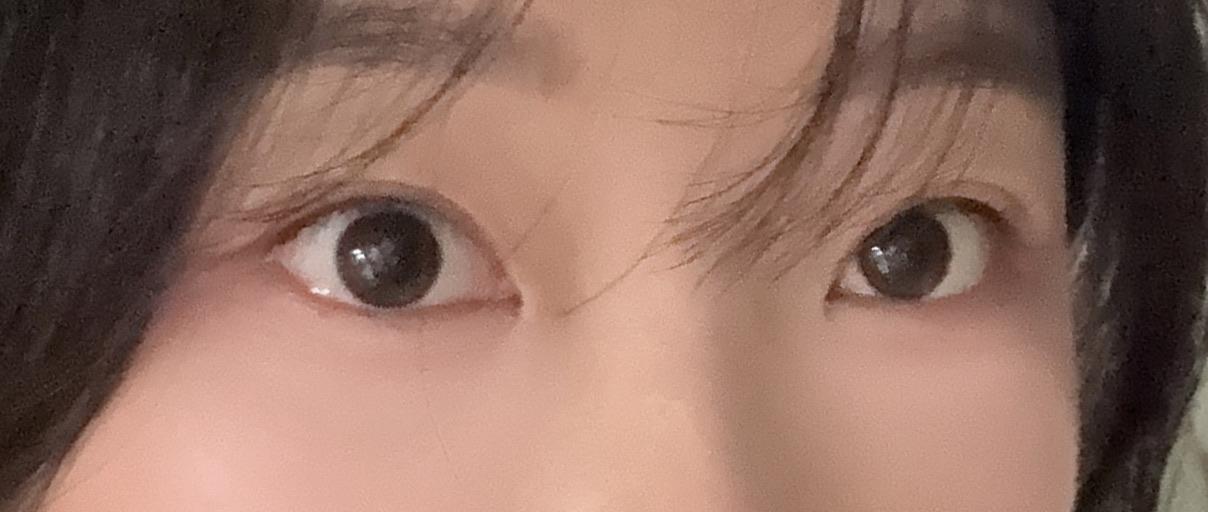 後