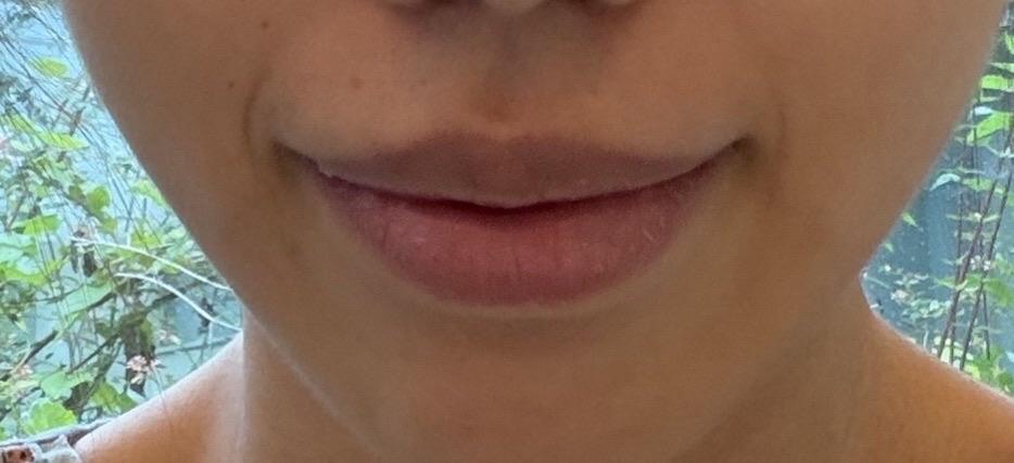 前