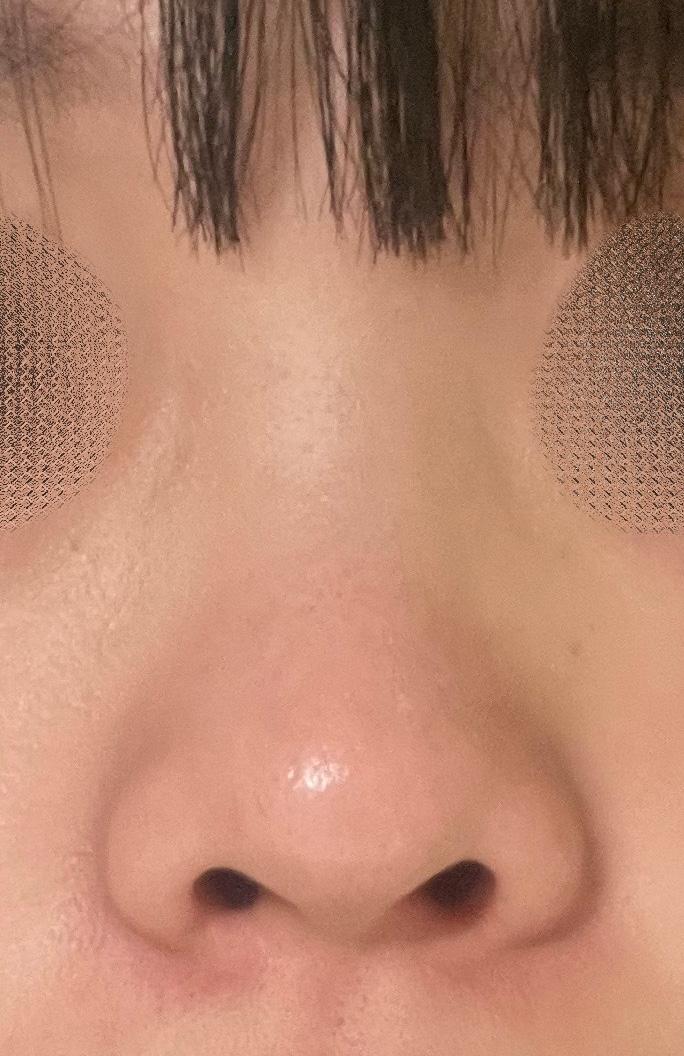 後