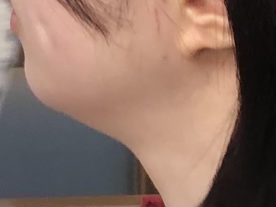 後