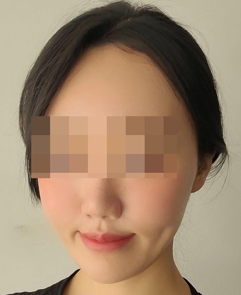 後