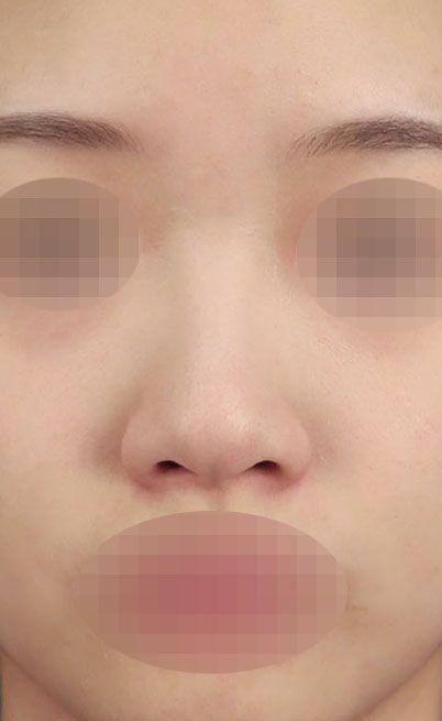後