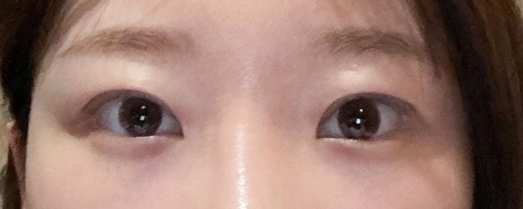 後