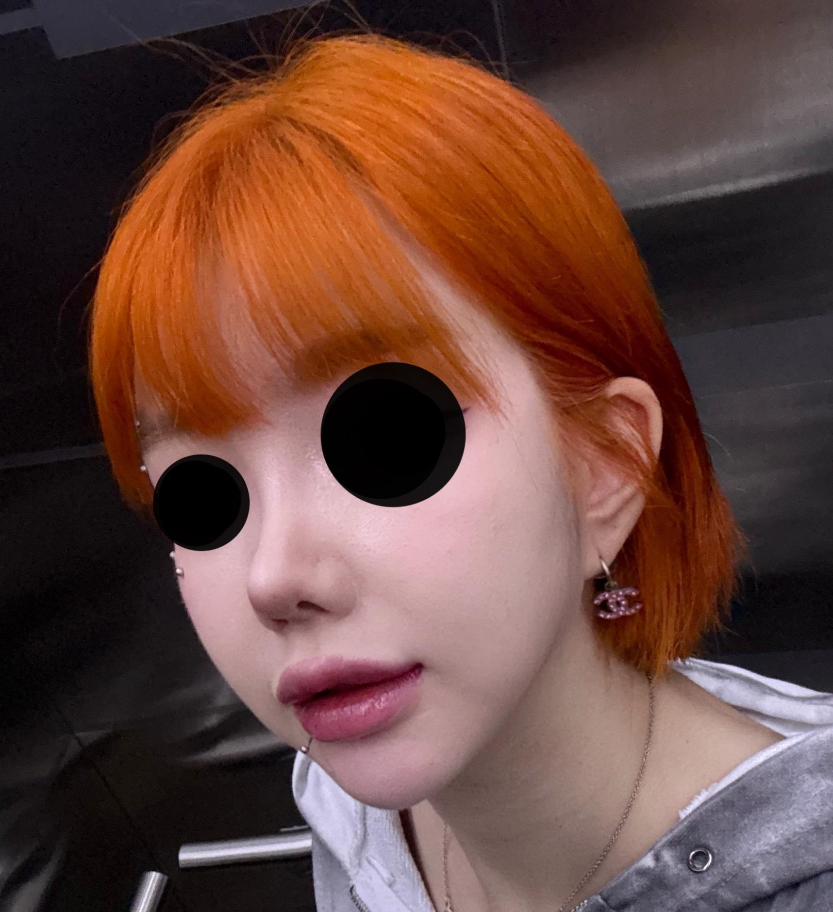 後