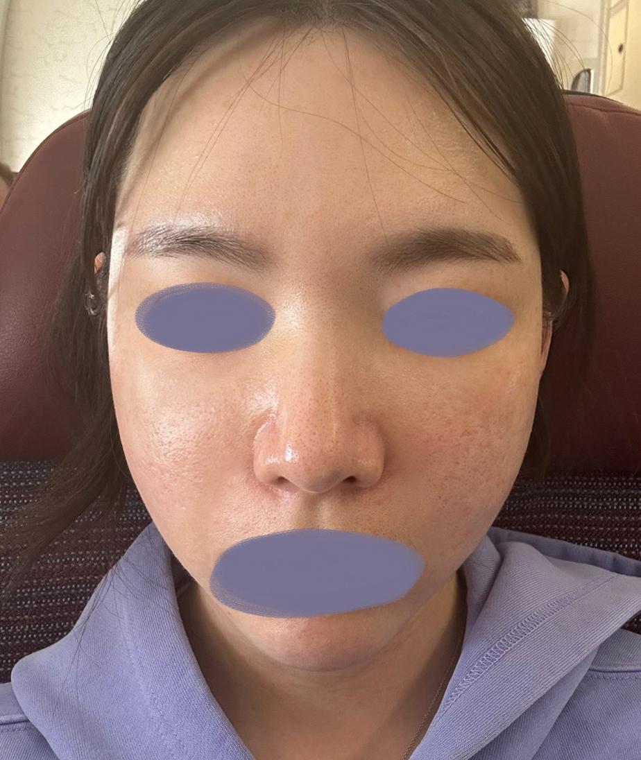後