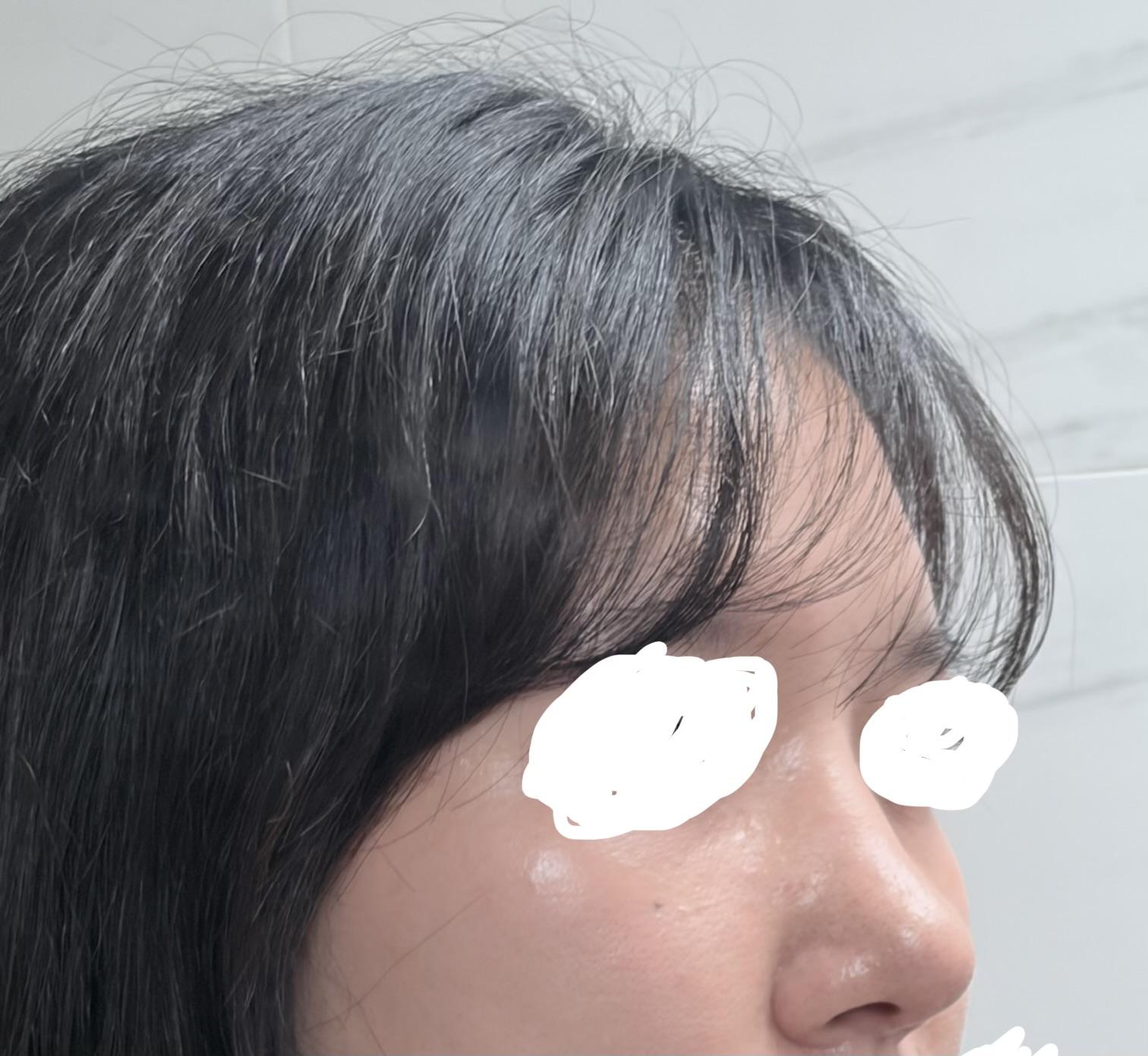 後