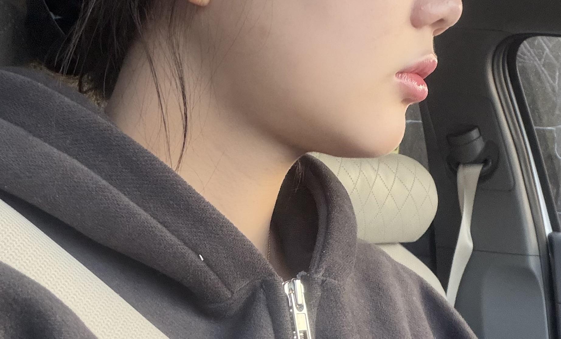 後