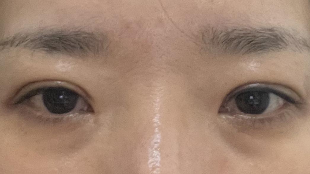 後