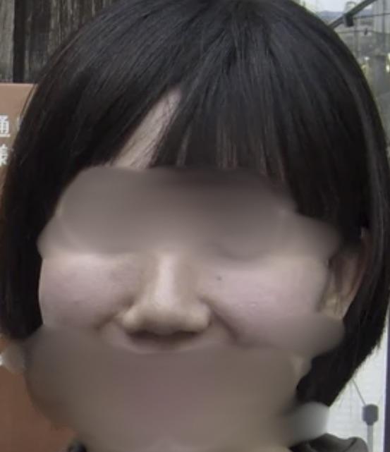 後