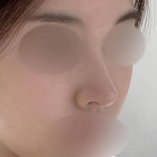 后