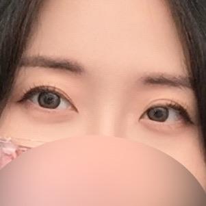 後