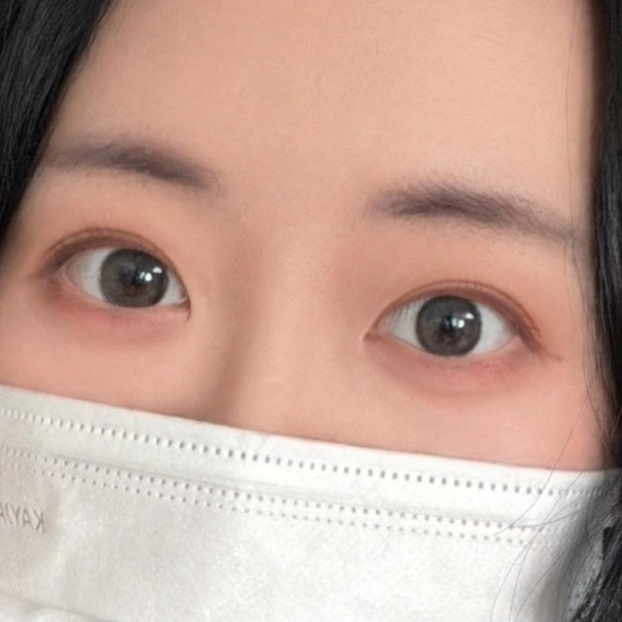後