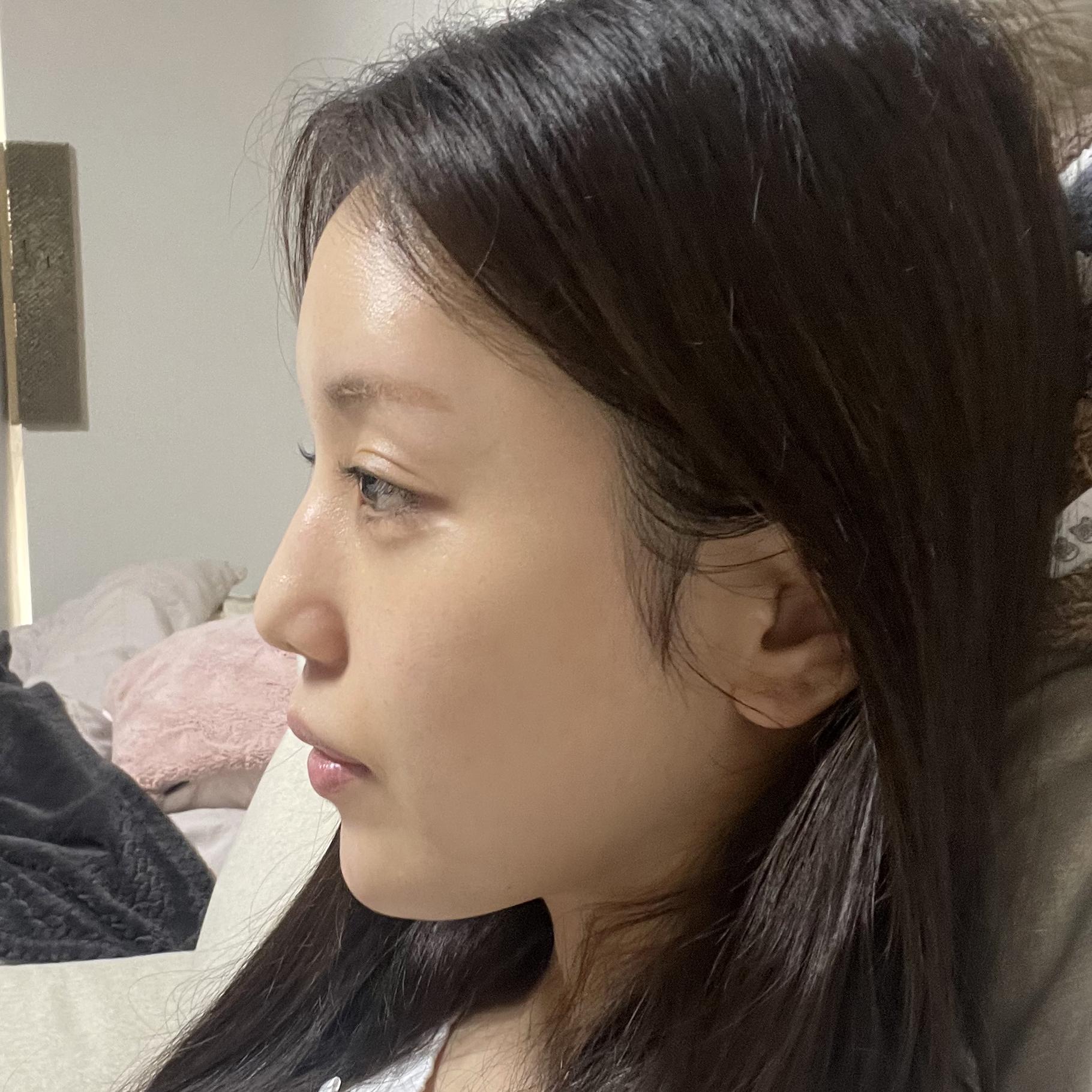 後