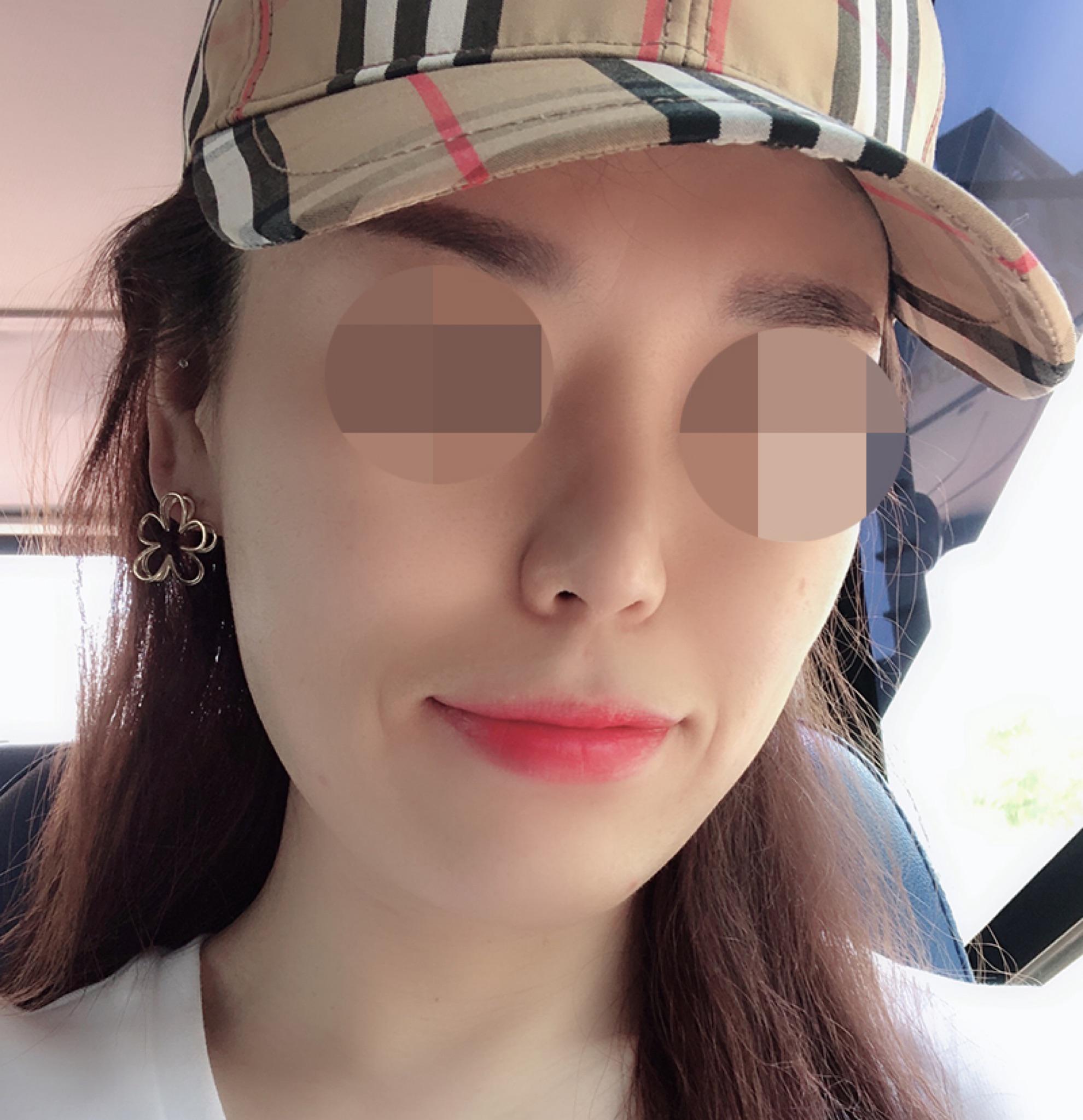 後