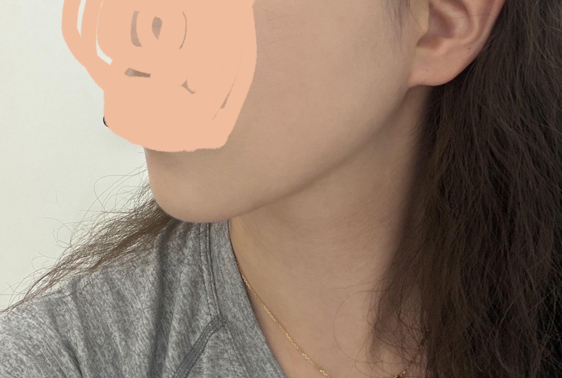 後