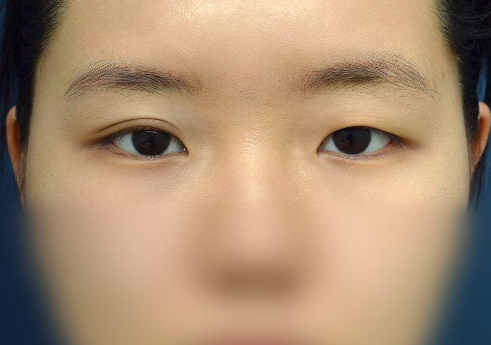 後