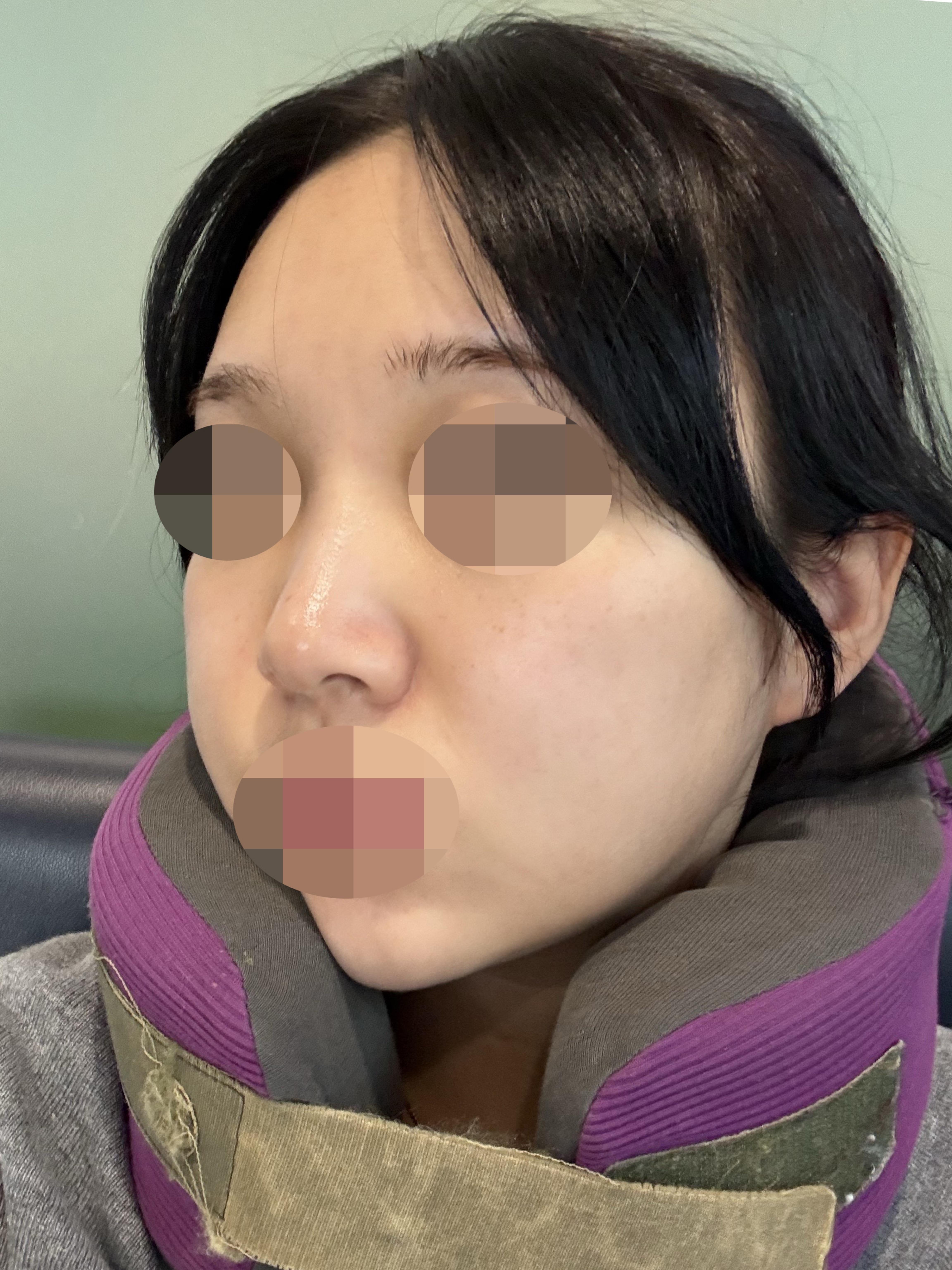 後