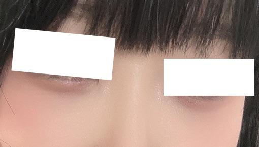 後