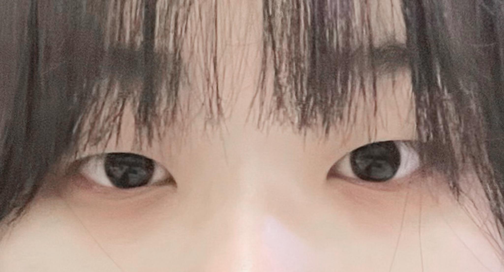 後