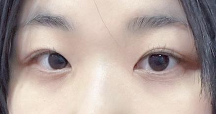 後