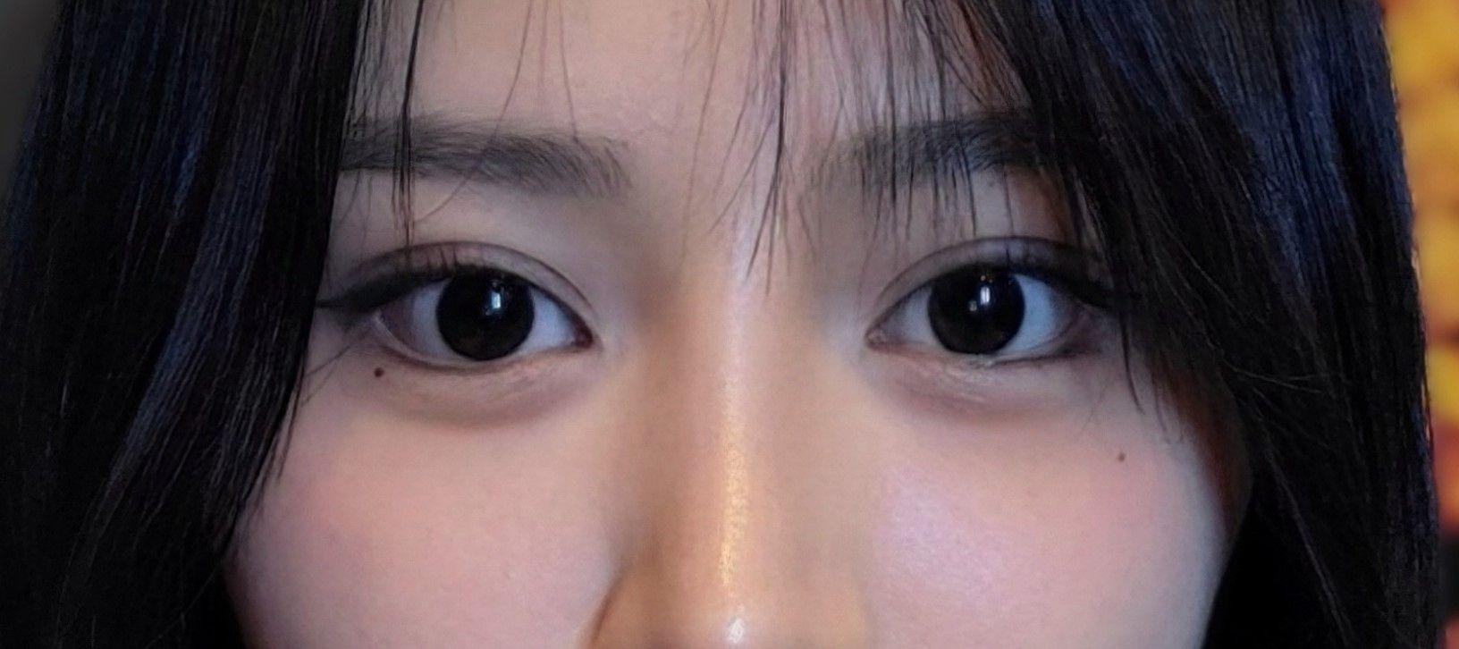 後