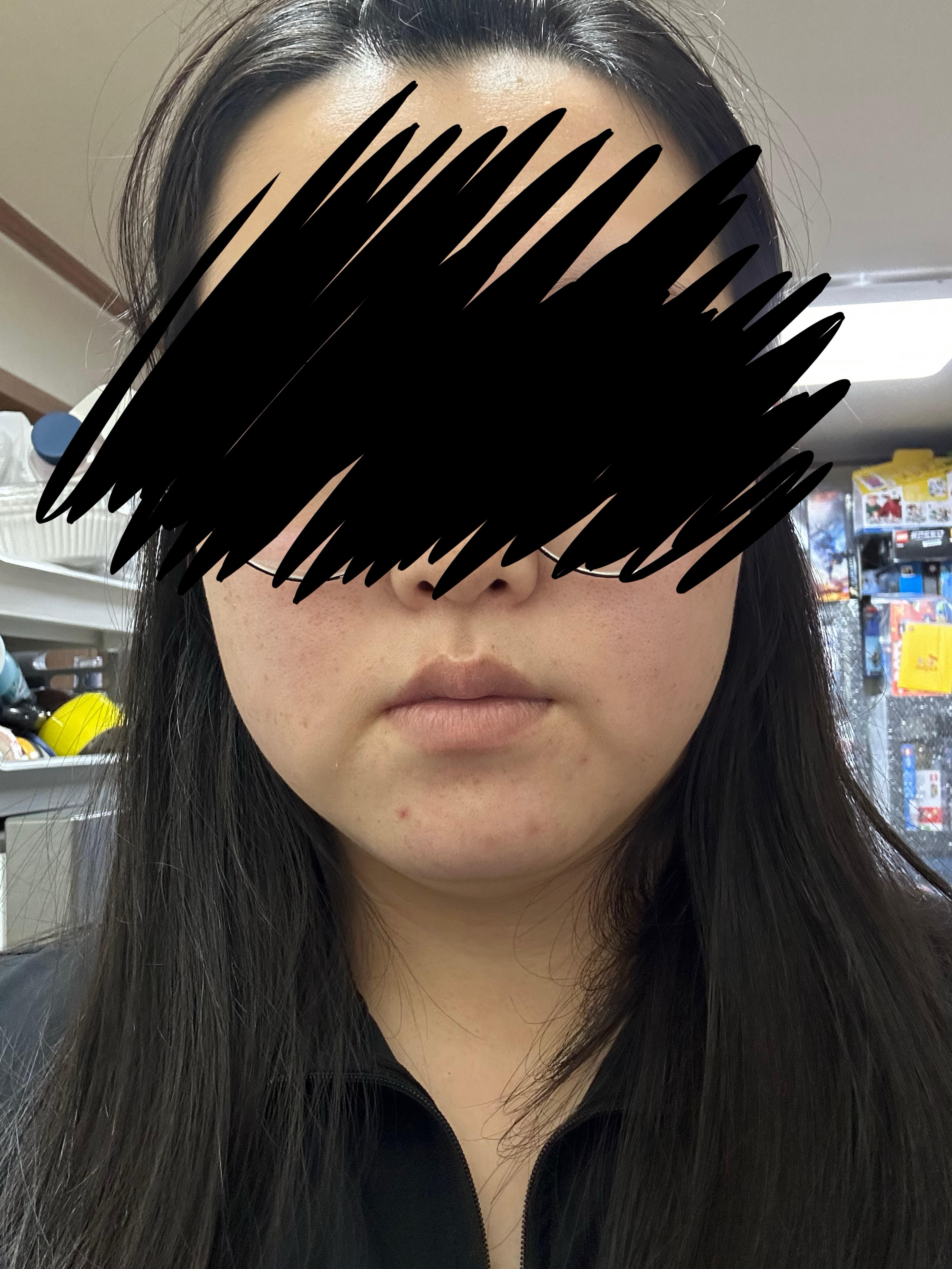 後
