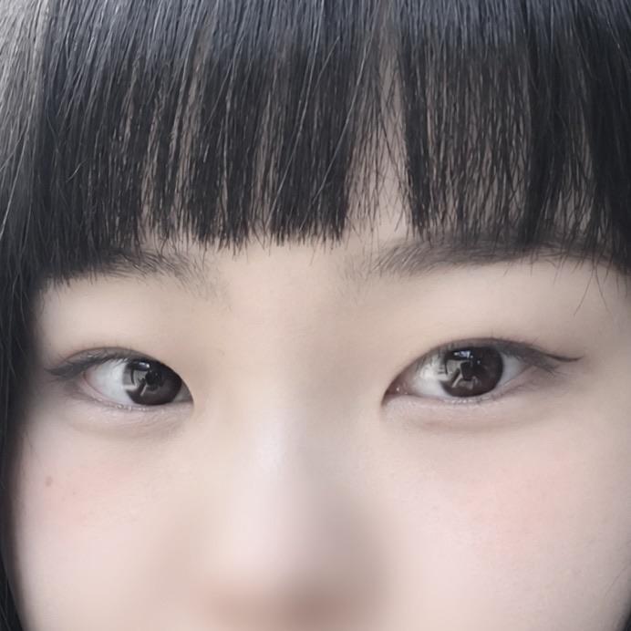 後