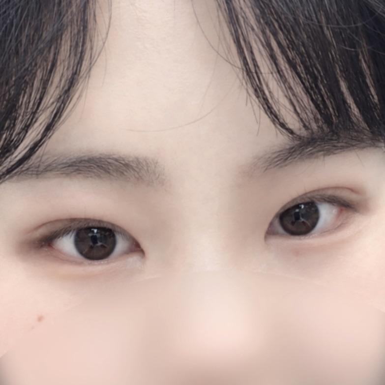 後