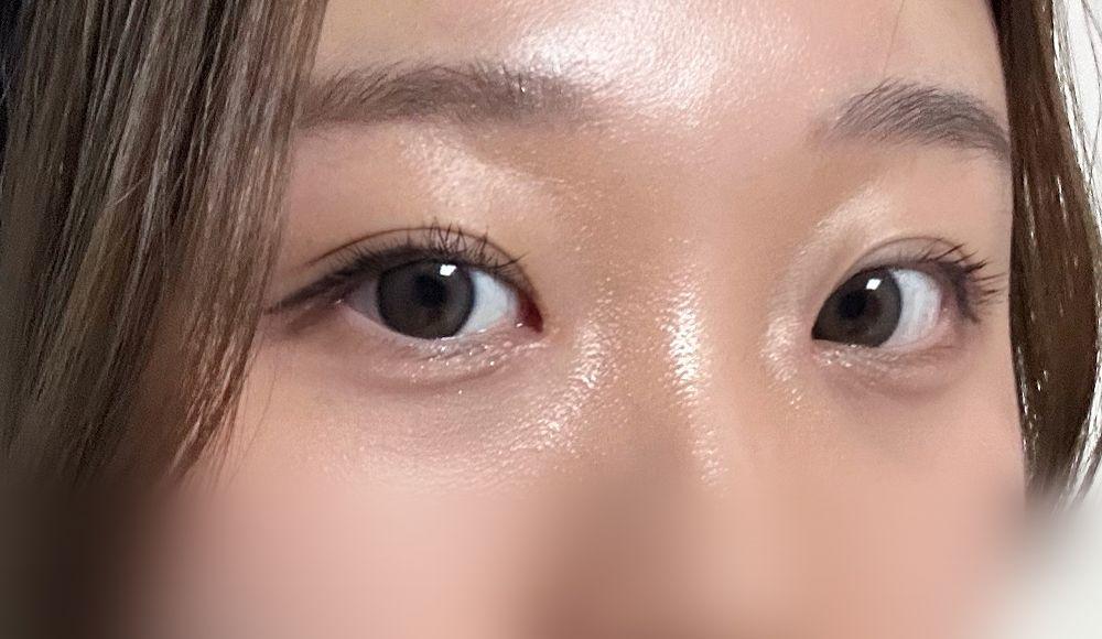 後