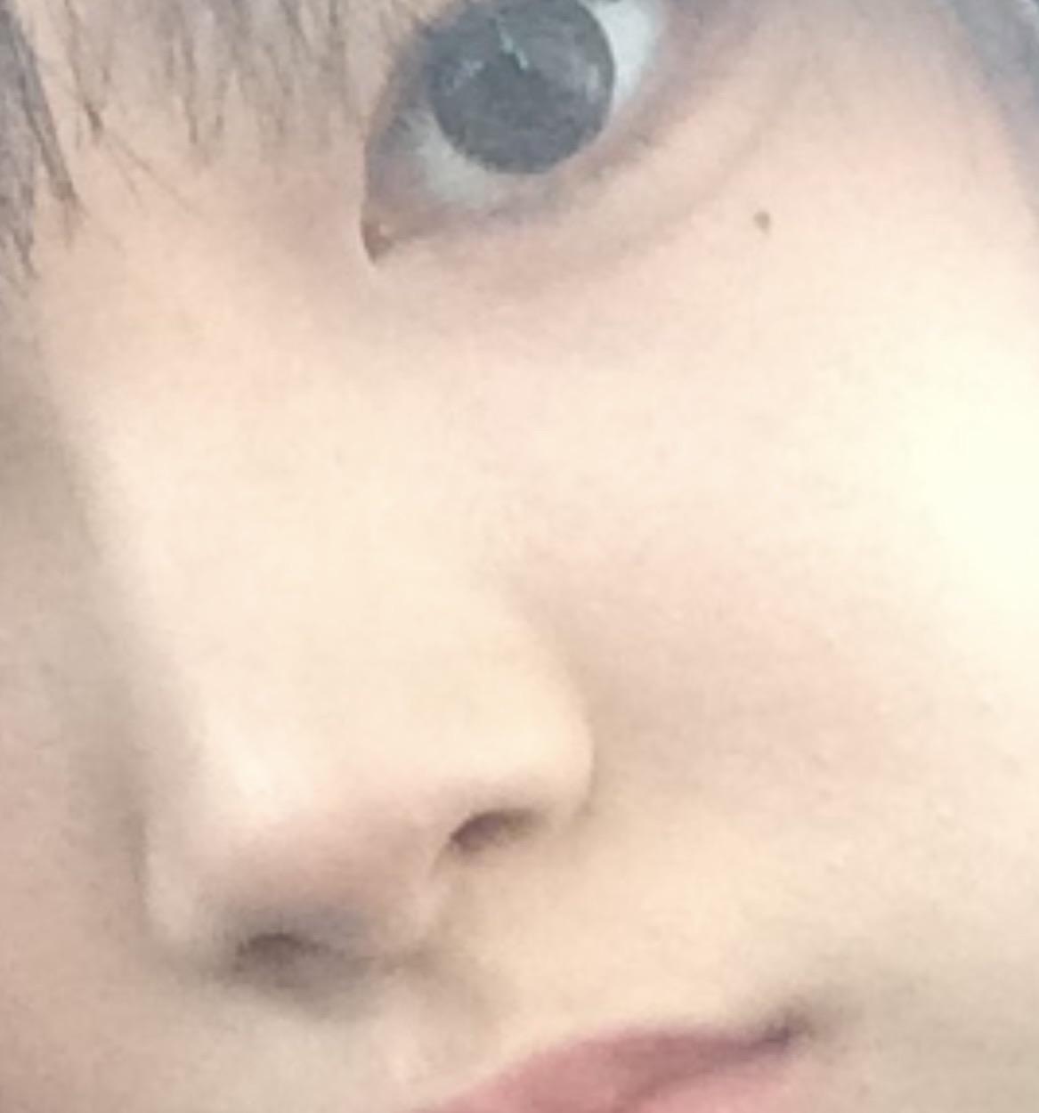 後