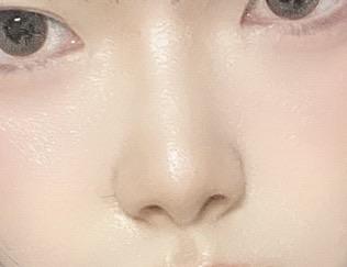 後