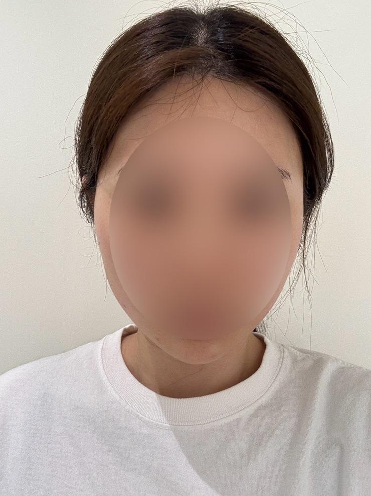 After