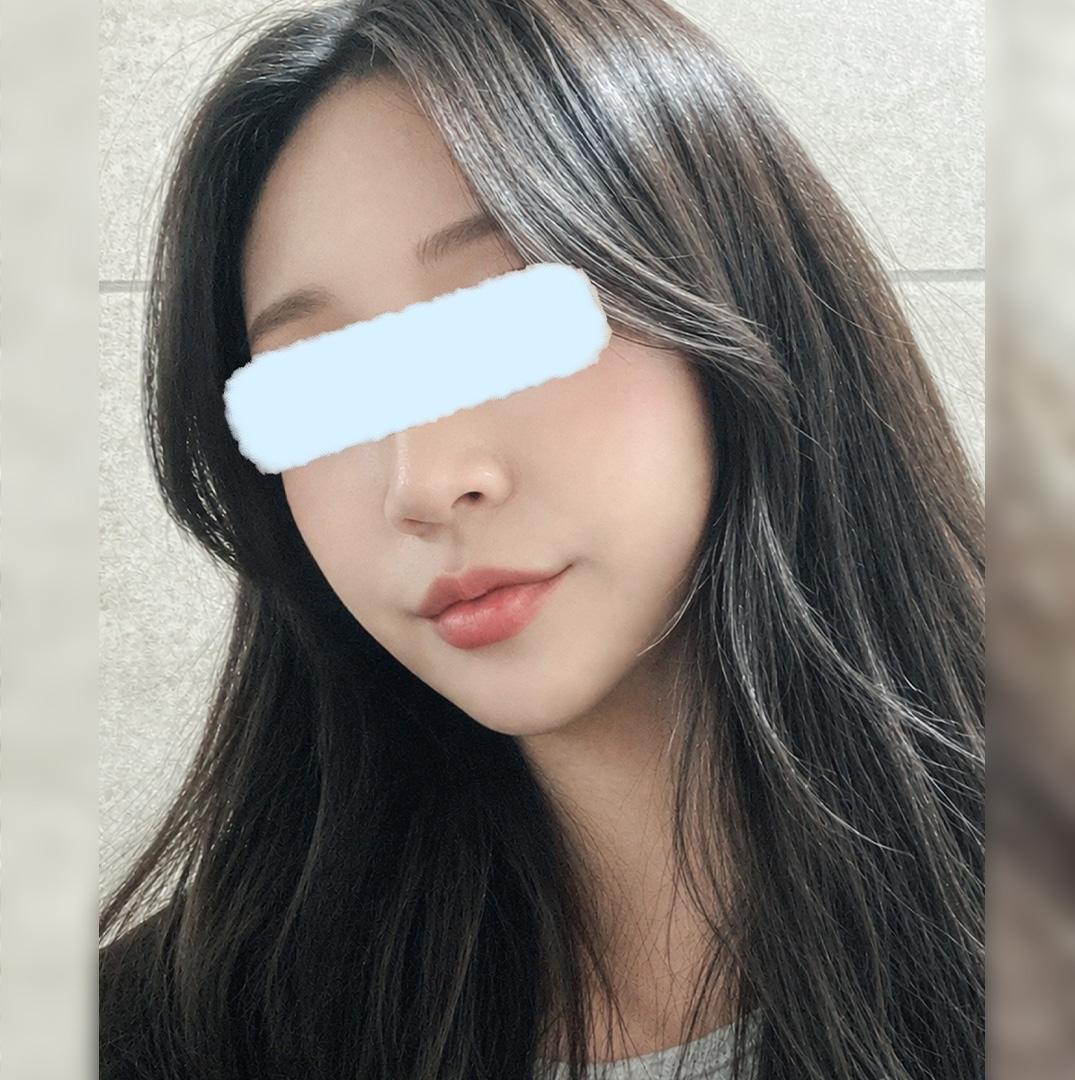 後