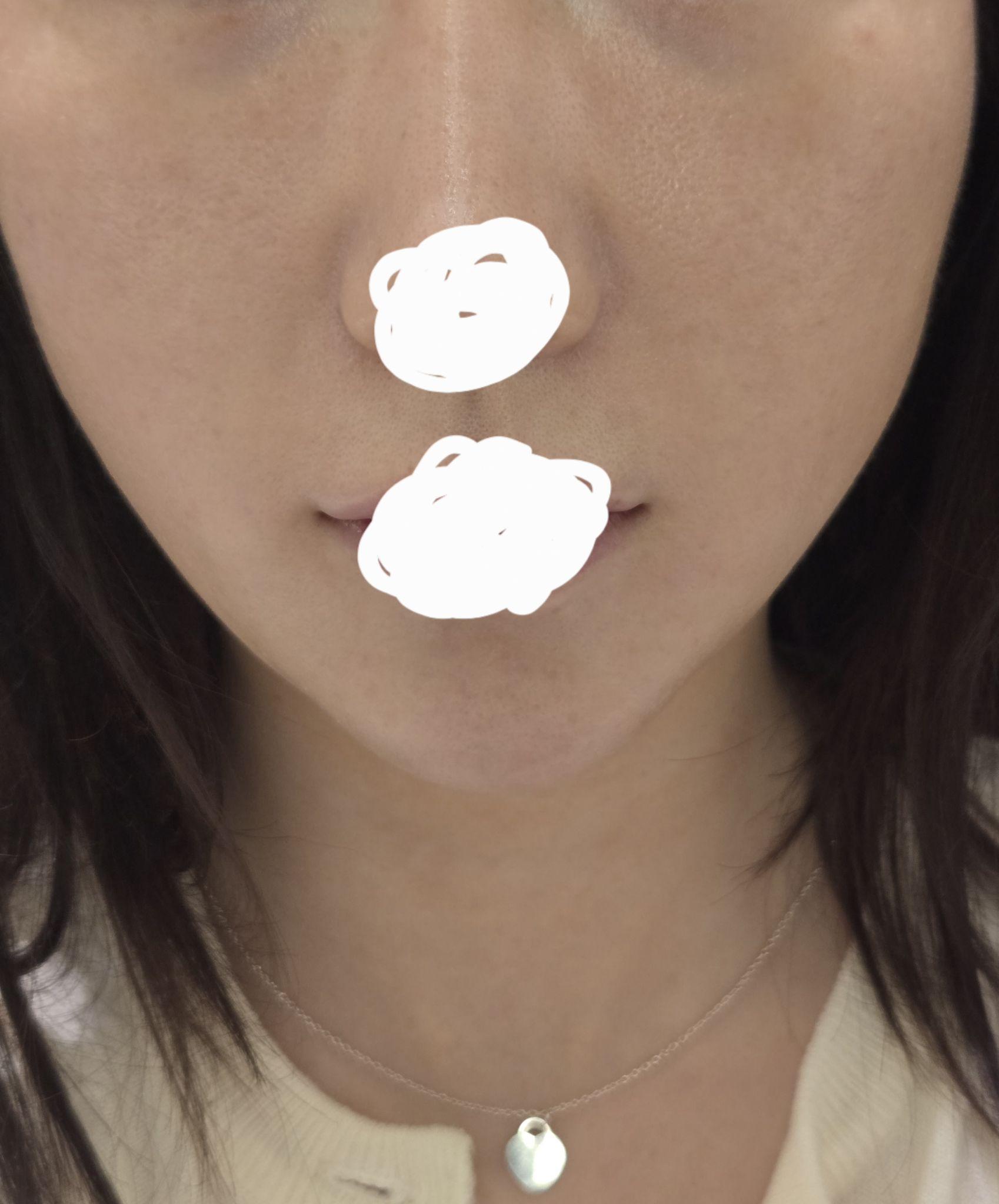 後
