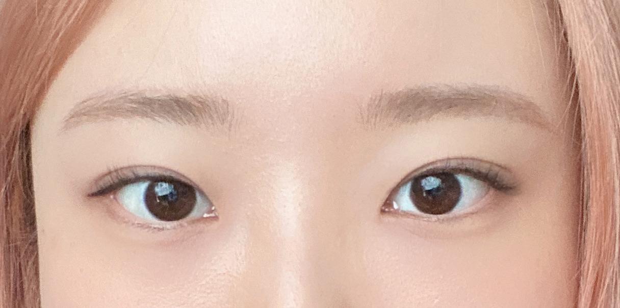 後