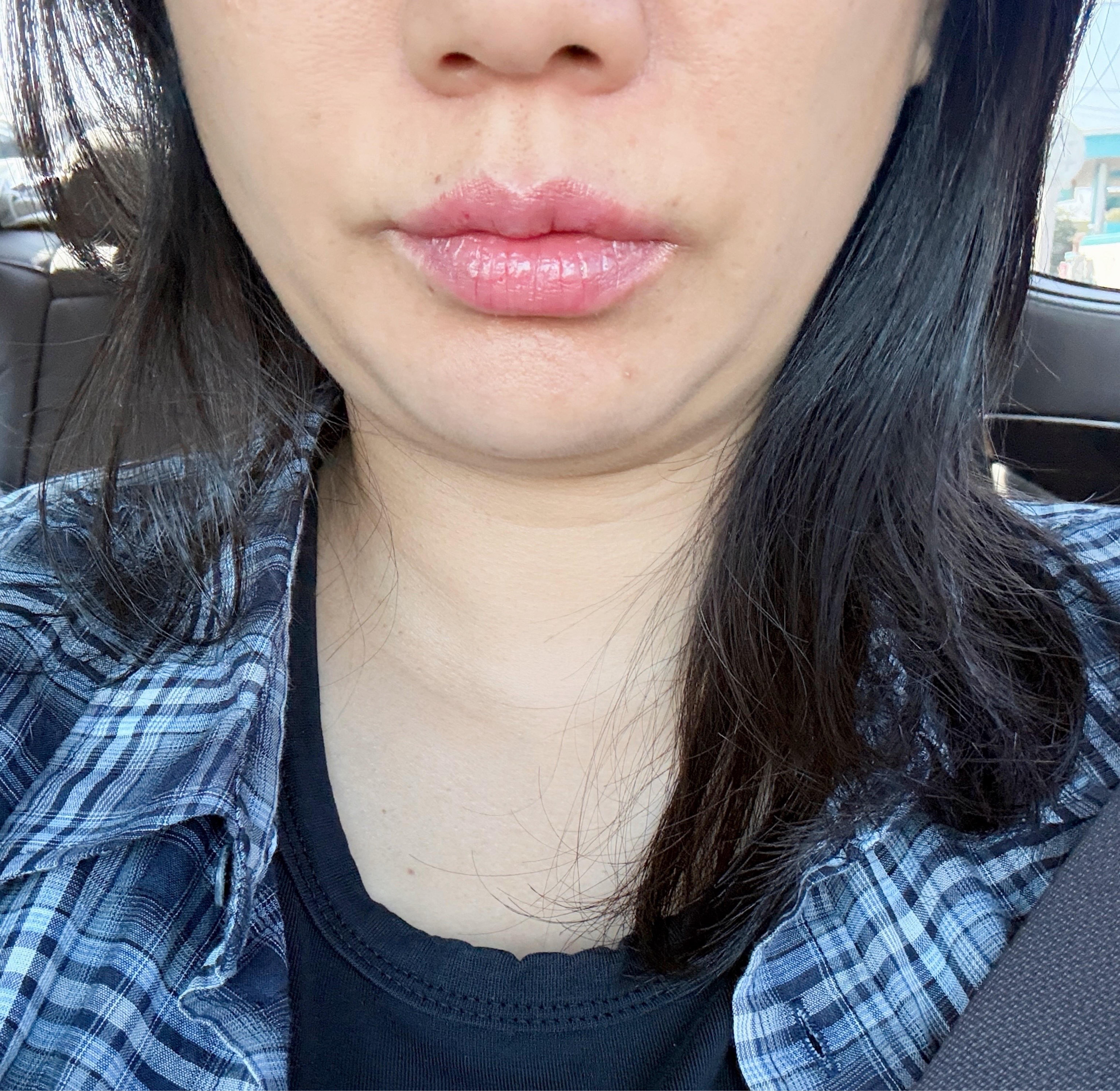 後