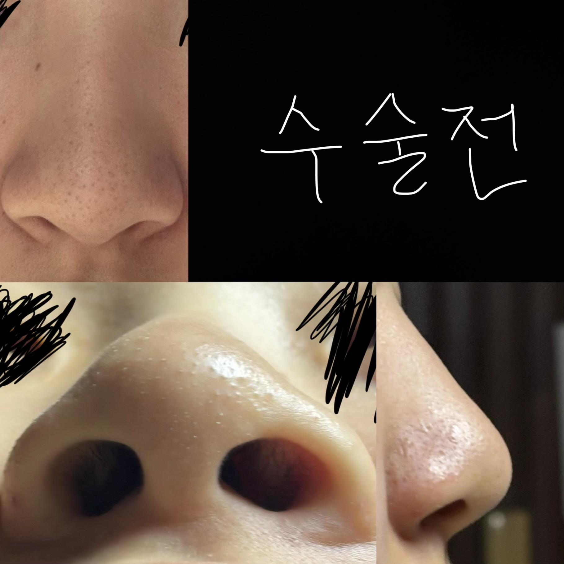 後
