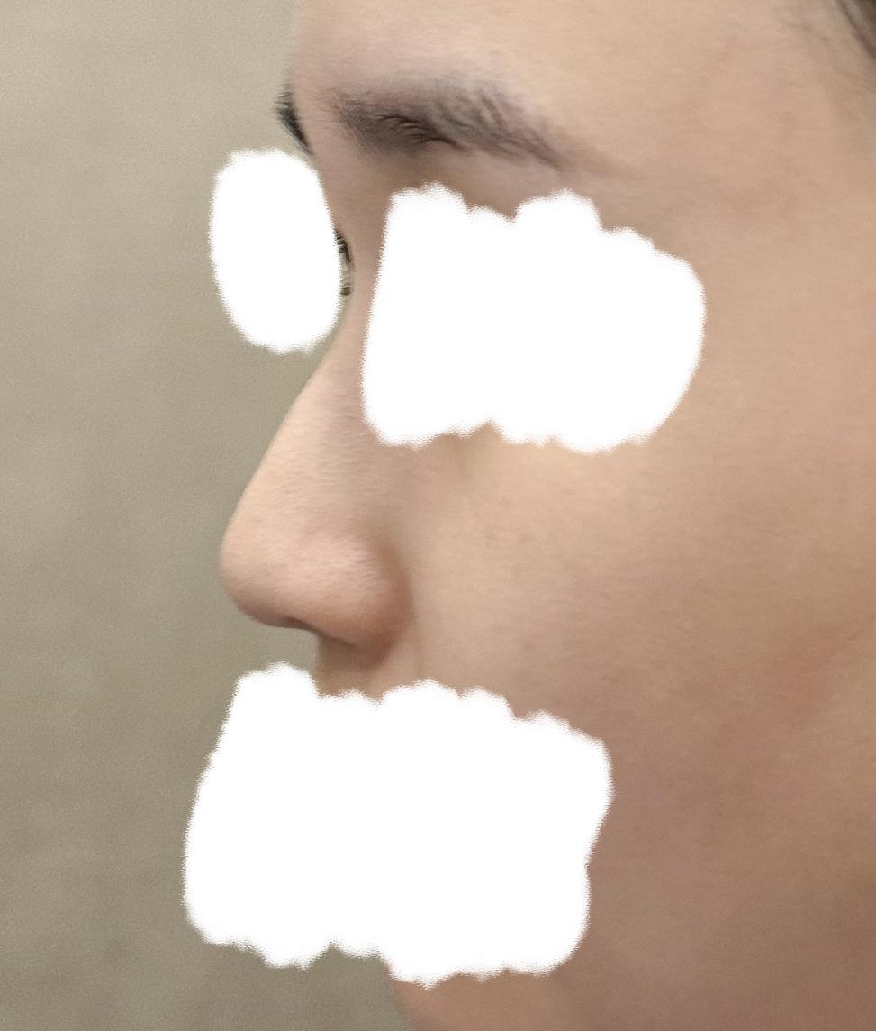 前
