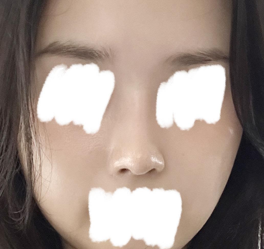 后