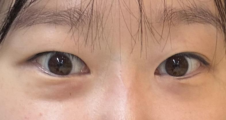 後