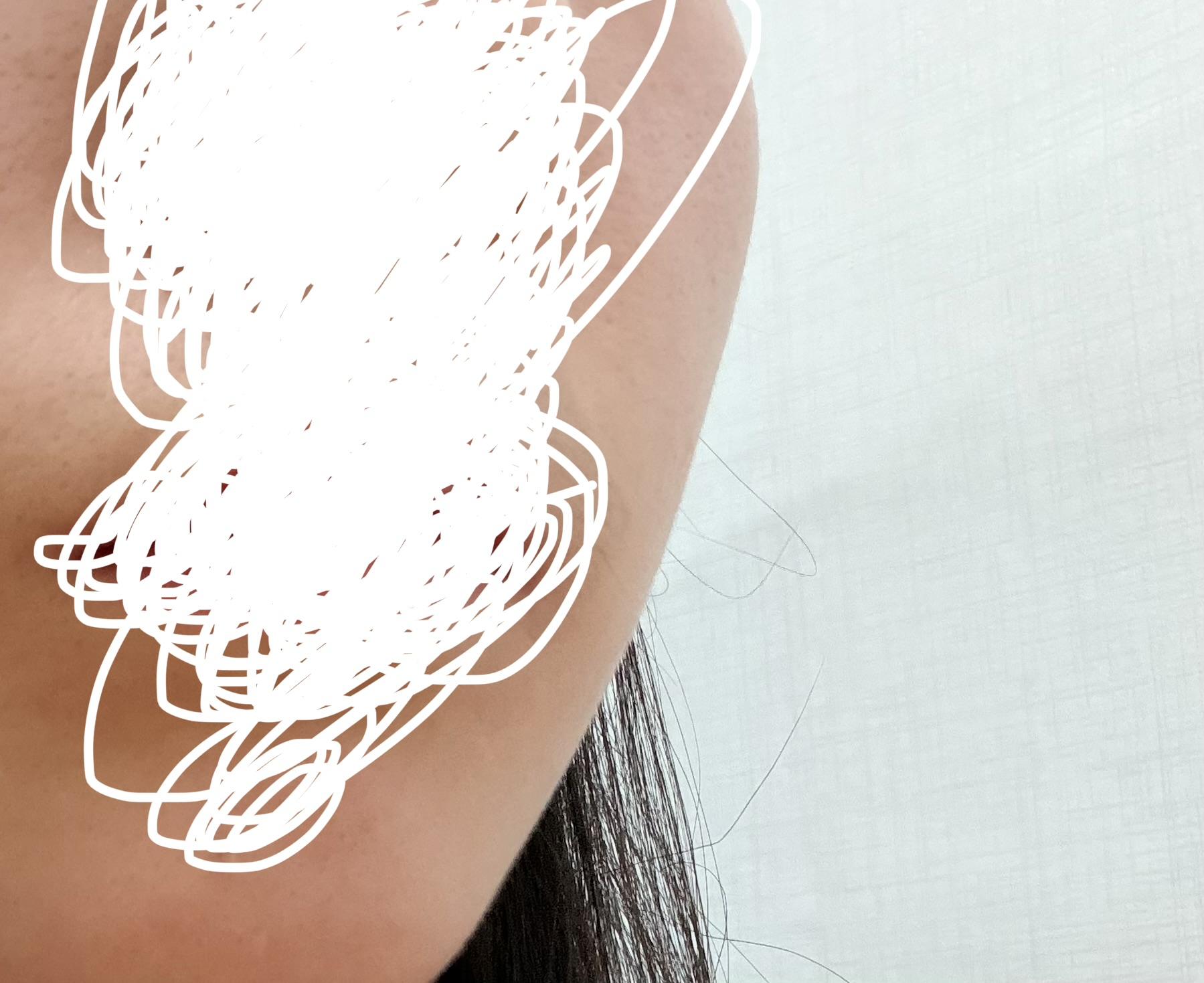 後