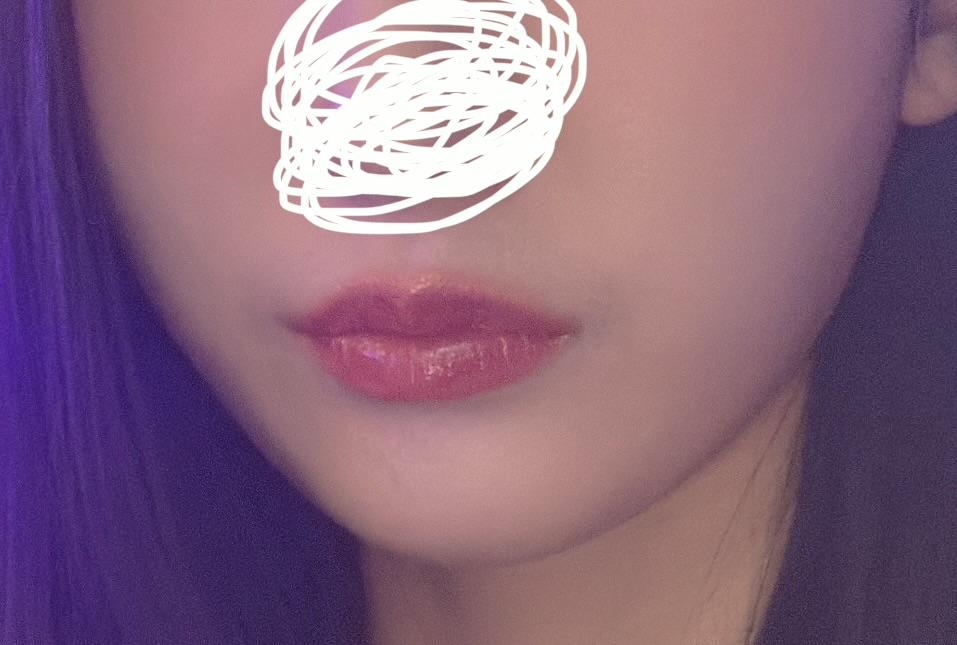 後