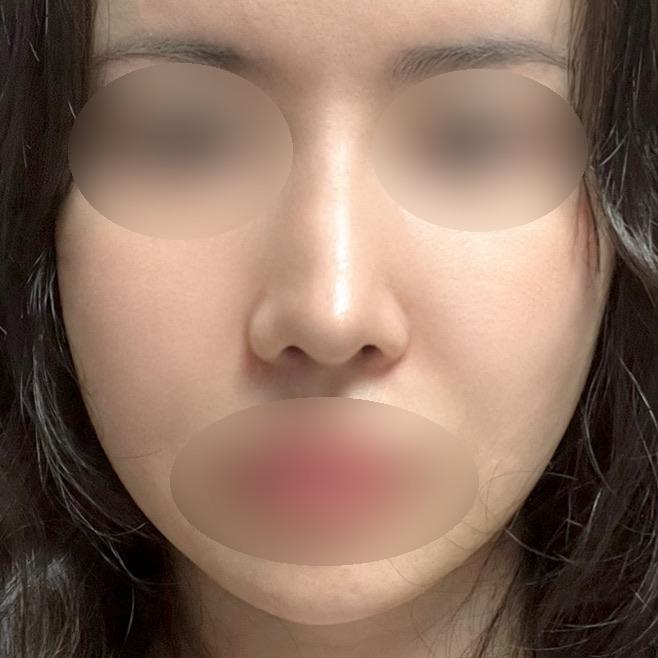 后
