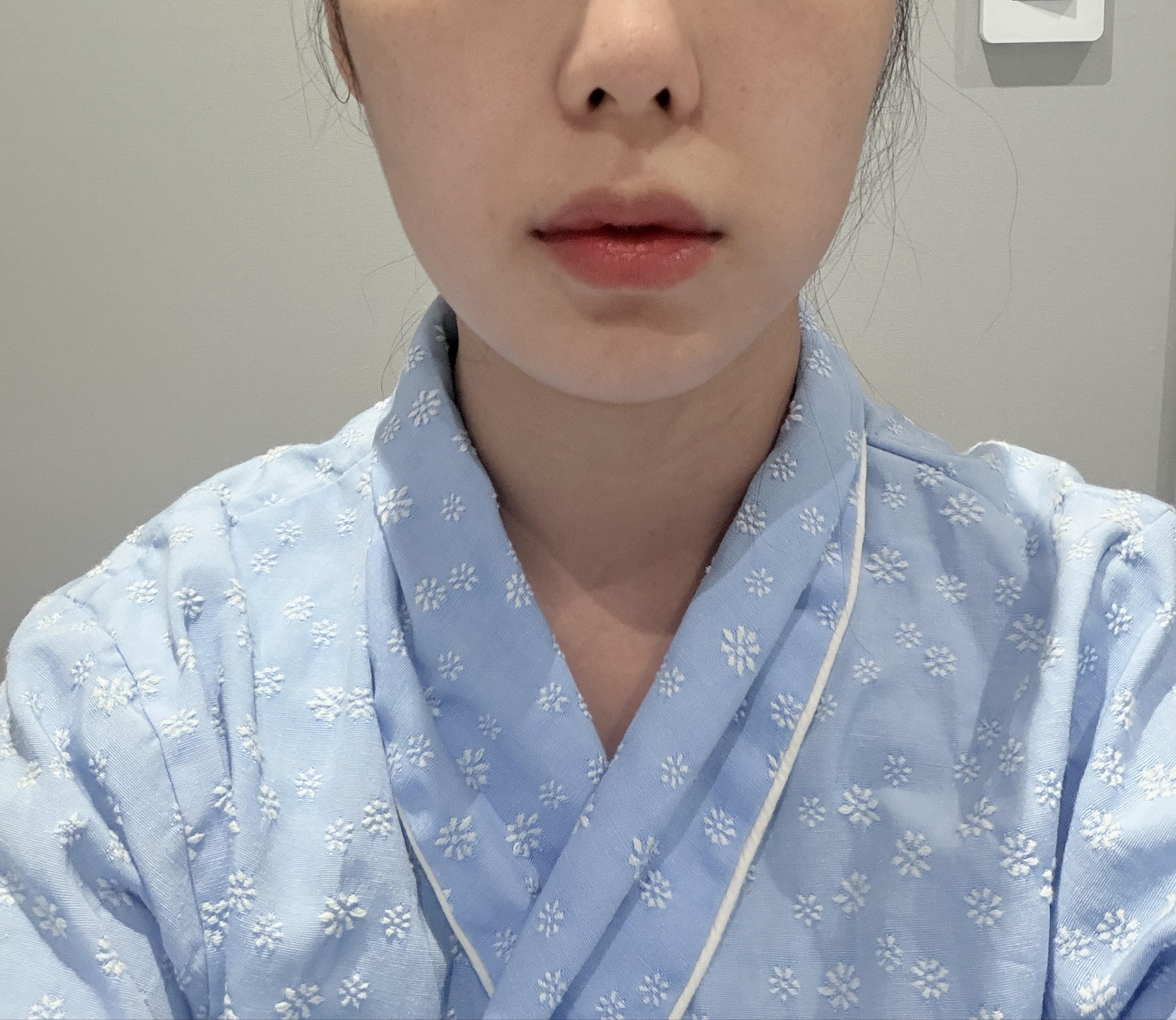 後