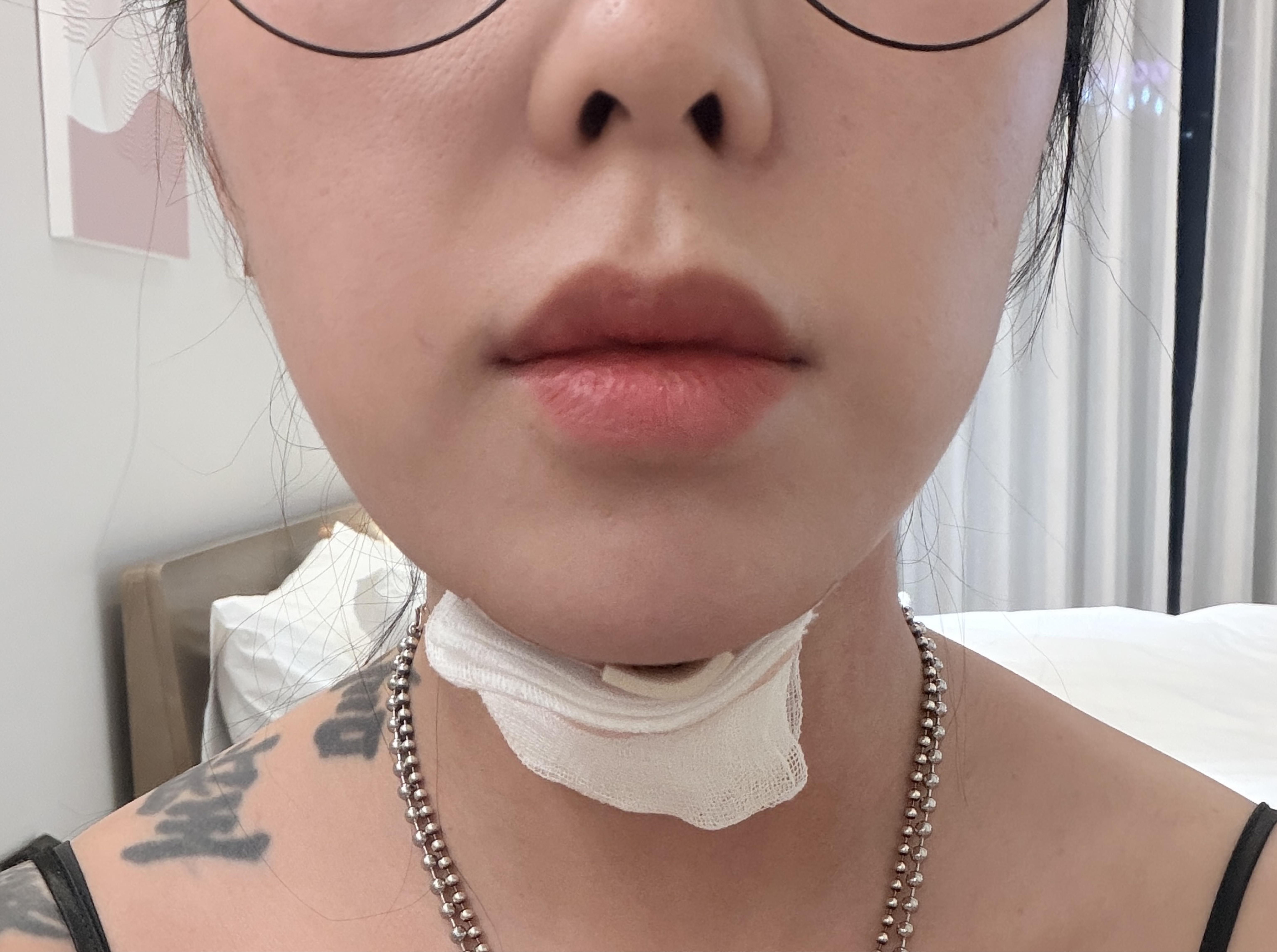 後