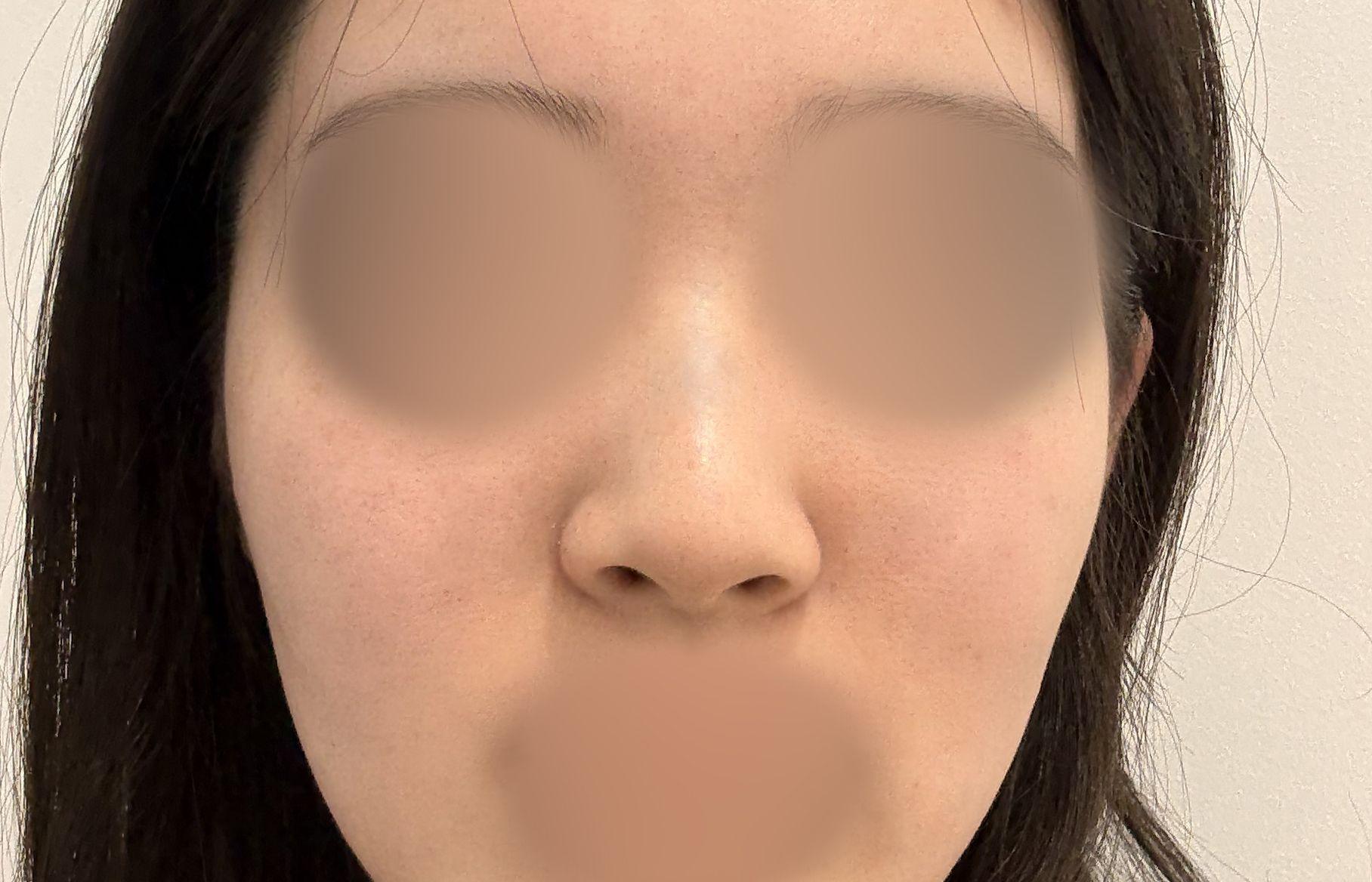 後