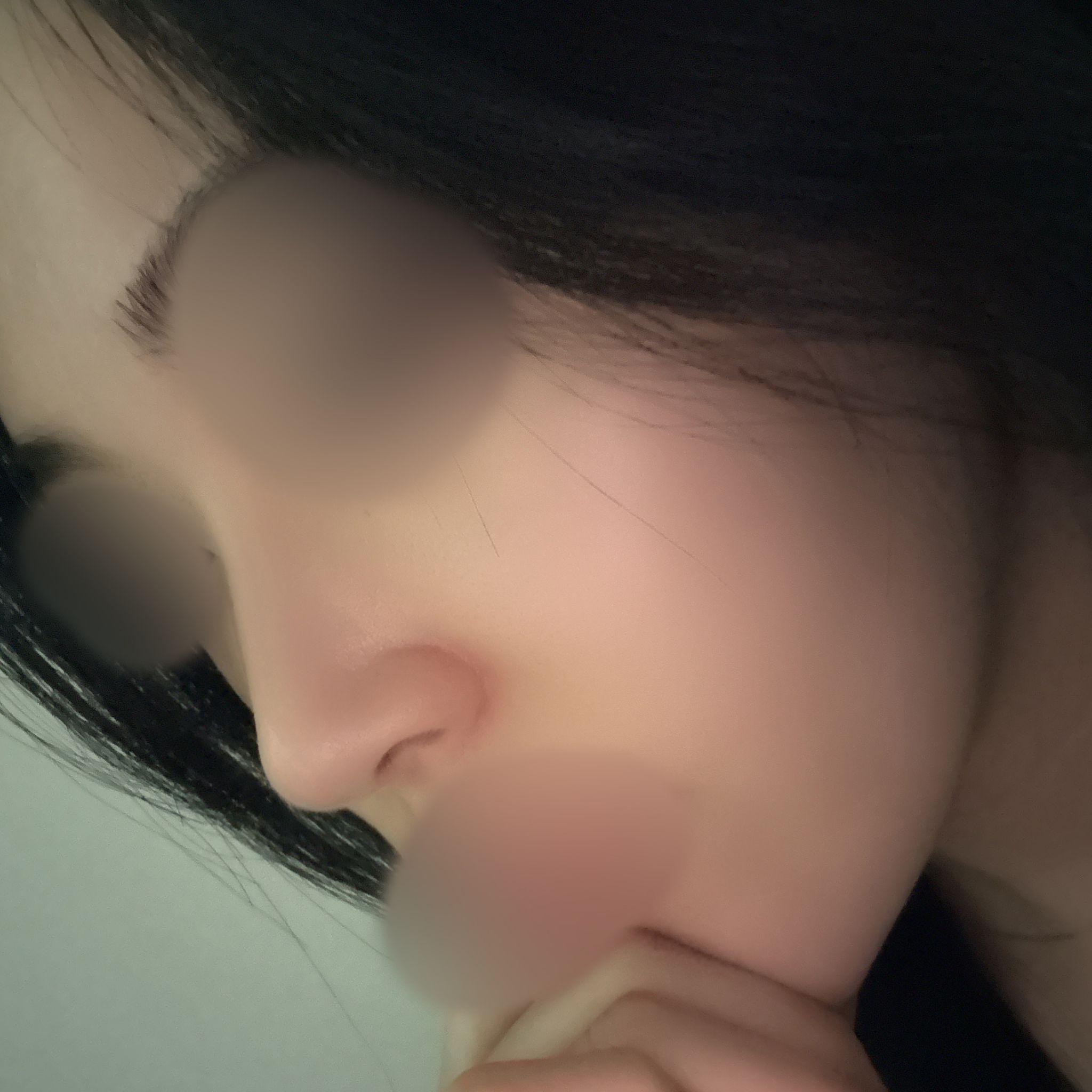 後